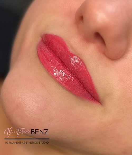 Lip blush & lip dermal filler3